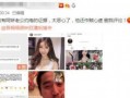 今日娱乐最新爆料网页,今日最新爆料大起底！